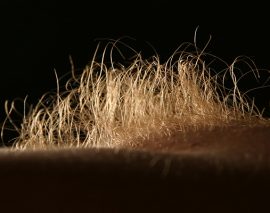 Zahl der behaarten Frauen in Deutschland sinkt drastisch