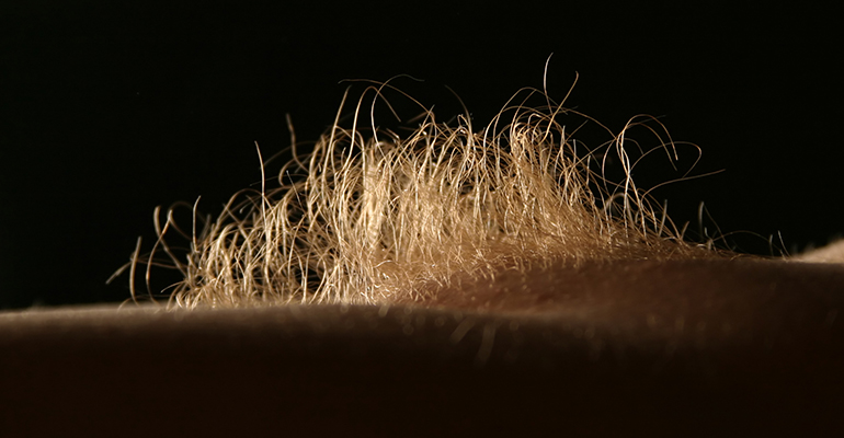 Zahl der behaarten Frauen in Deutschland sinkt drastisch