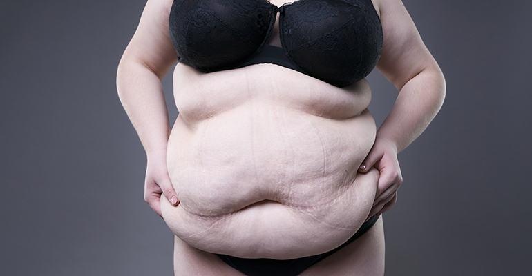 Schönheit liegt im Auge des Betrachters