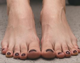 Können hässliche Frauenfüße anziehend sein?